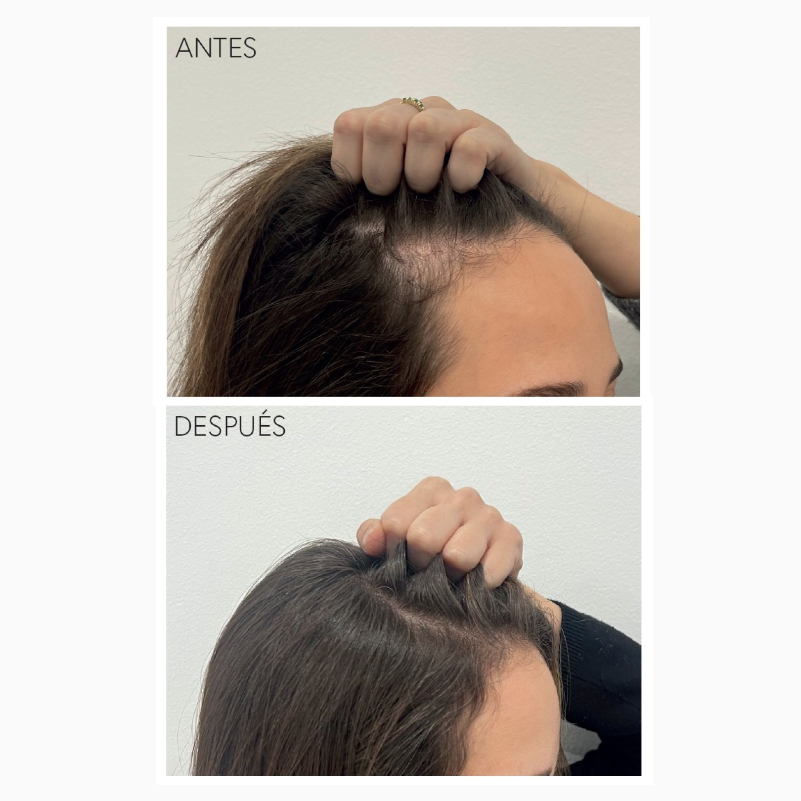 RAPUNHAIR